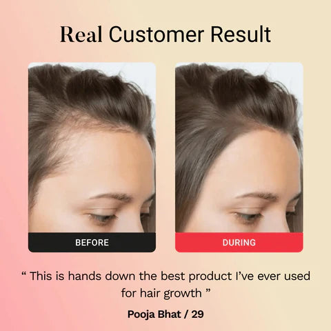 Lunnexi™ - Hair Revival Wand