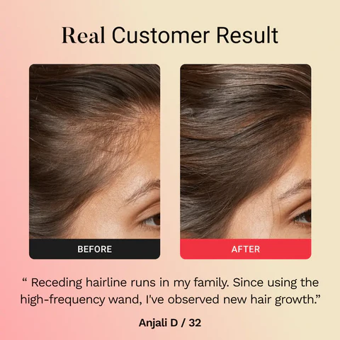 Lunnexi™ - Hair Revival Wand