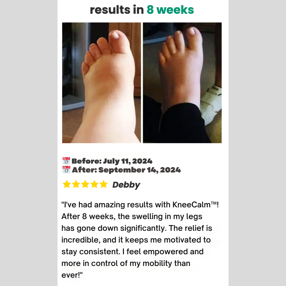 KneeCalm™ - 3in1 Knee Massager
