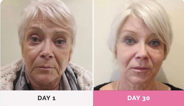 SolarLift™ - Face Sculptor Massager