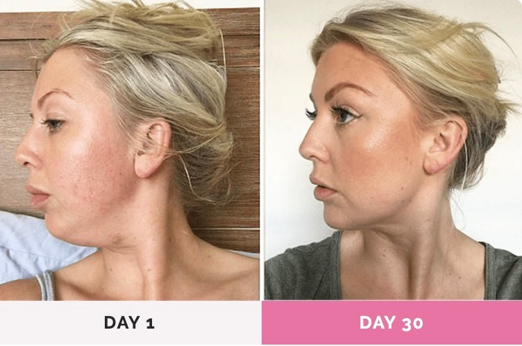 SolarLift™ - Face Sculptor Massager