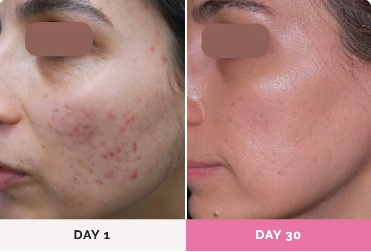 SolarLift™ - Face Sculptor Massager