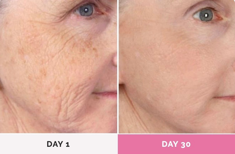 SolarLift™ - Face Sculptor Massager