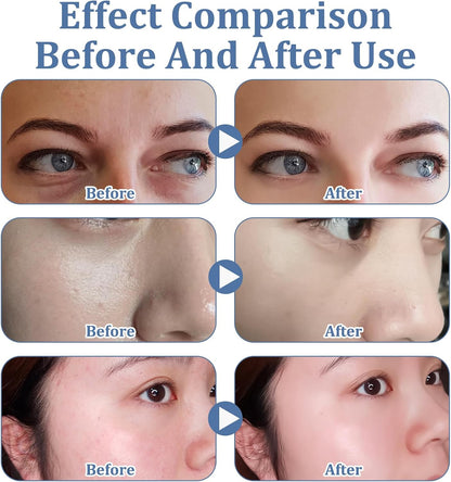 Anti-Aging Collagen Face Mask (x5)