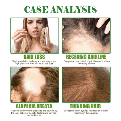 Rosemary Hair Oil