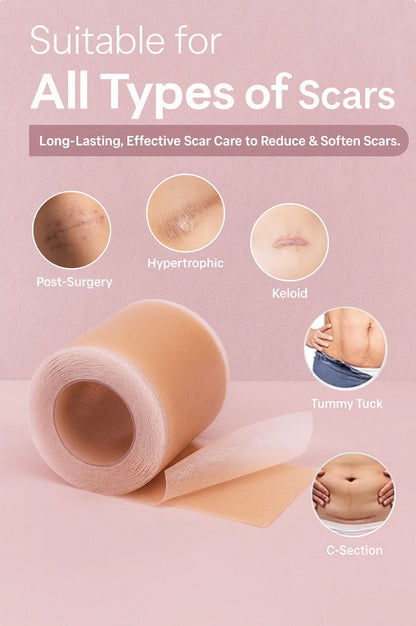 Lunnexi™ - Scar Tape (4x300cm)