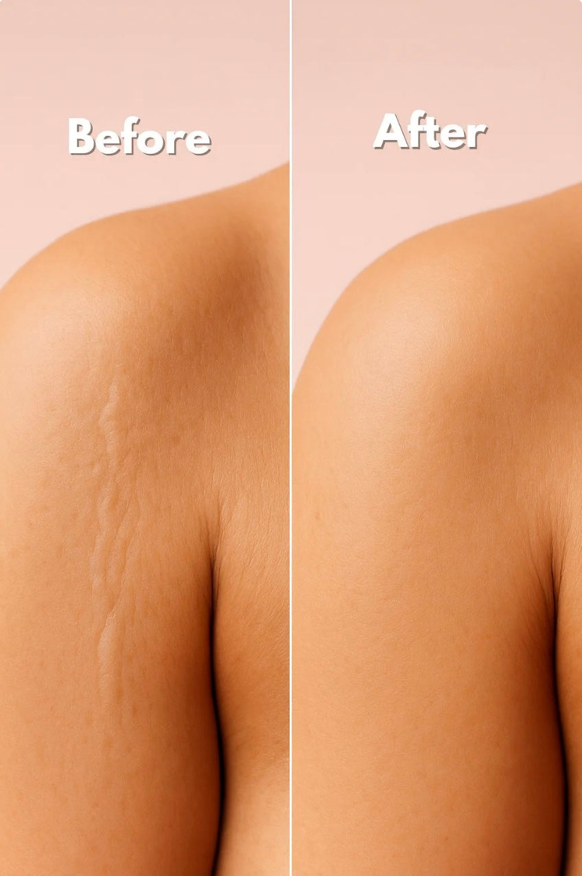 Lunnexi™ - Scar Tape (4x300cm)