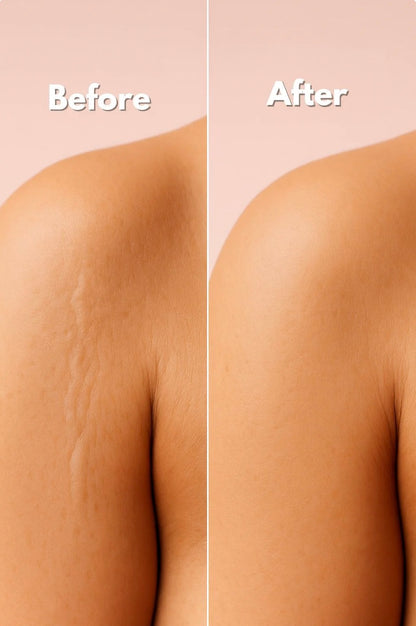 Lunnexi™ - Scar Tape (4x300cm)