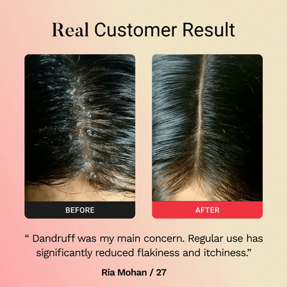 Lunnexi™ - Hair Revival Wand