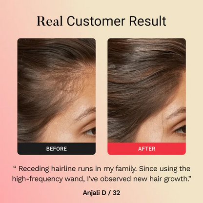 Lunnexi™ - Hair Revival Wand
